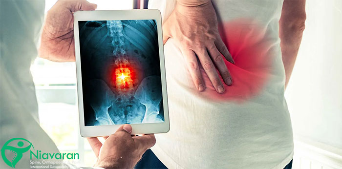 عمل دیسکوپاتی کمر