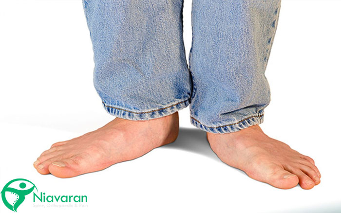 علت صاف بودن کف پا