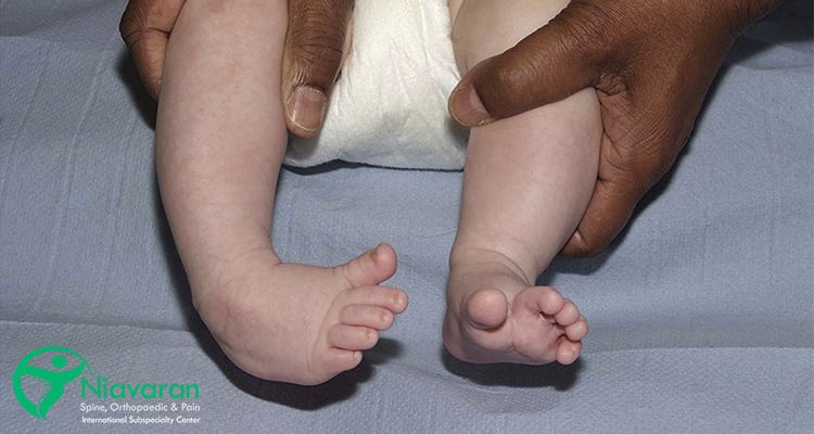 پاچنبری کودکان