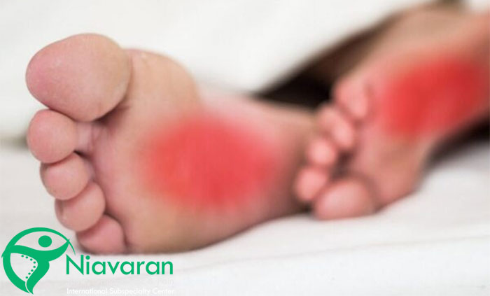 علت داغی کف پا 