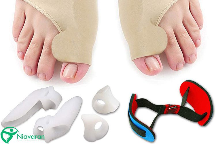 درمان انحراف شست پا در خانه