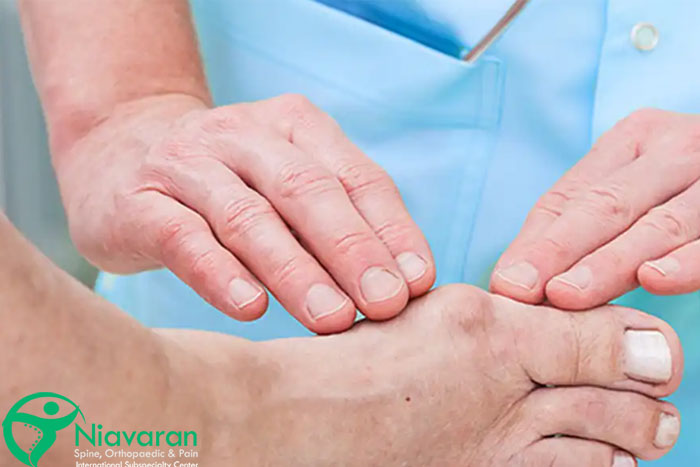 عوارض جراحی هالوکس والگوس