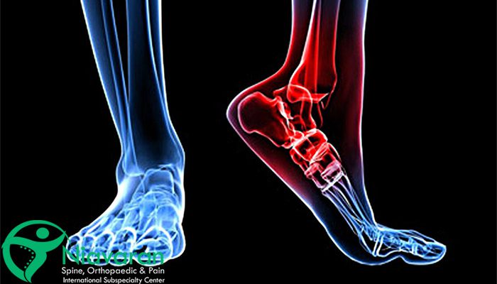 ساییدگی مچ پا و احساس درد