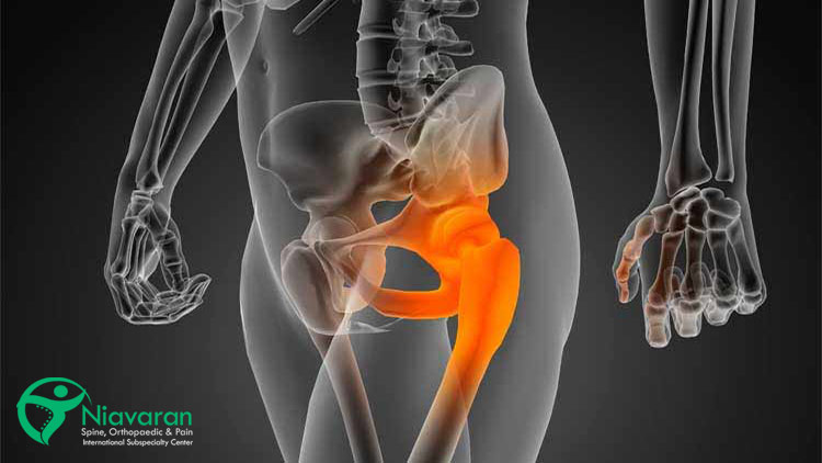 آسیب ناحیه لگن