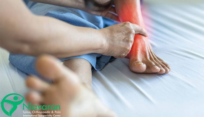 درد براثر شکستگی قوزک پا
