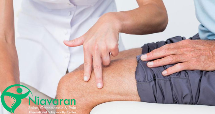 تعویض مفصل زانو