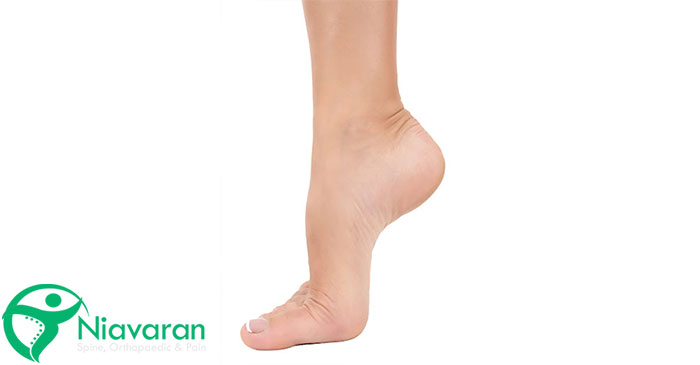 روش‌های غیرجراحی برای درمان گودی کف پا