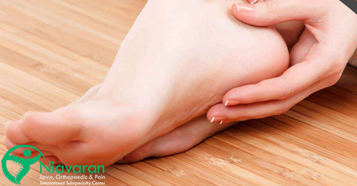 عوارض گودی زیاد کف پا