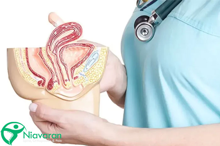 تشخیص پرولاپس لگن