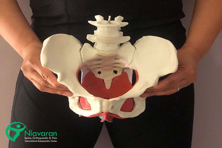 درمان افتادگی لگن