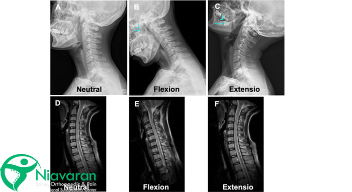 تفسیر ام آر آی گردن چگونه است؟