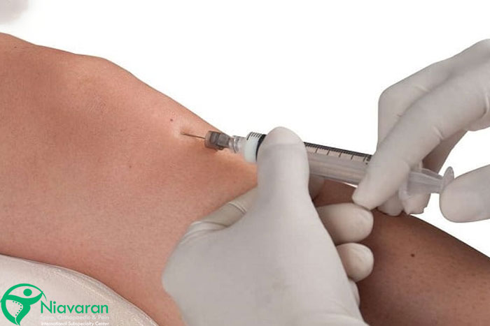 هزینه اوزون تراپی زانو چقدر است؟