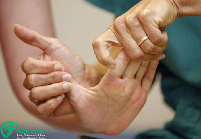 علائم کرامپ دست کدامند؟