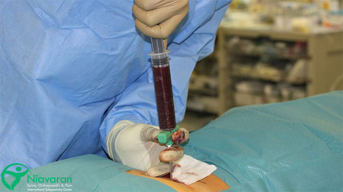 مراحل و نحوه انجام آزمایش بیوپسی