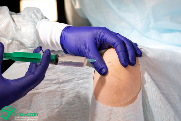 اقدامات پیش از تزریق ژل به زانو