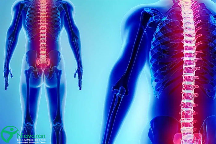 آناتومی ستون فقرات