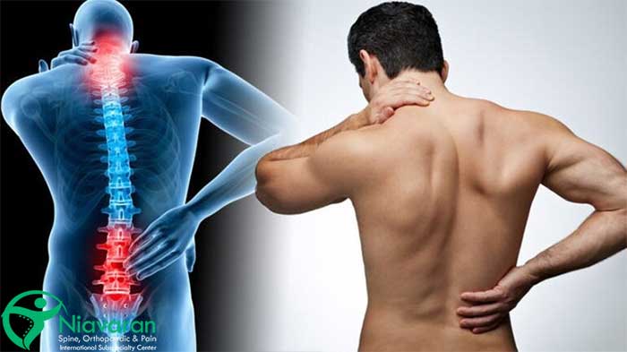 مشکلات اسکلتی عضلانی چیست؟