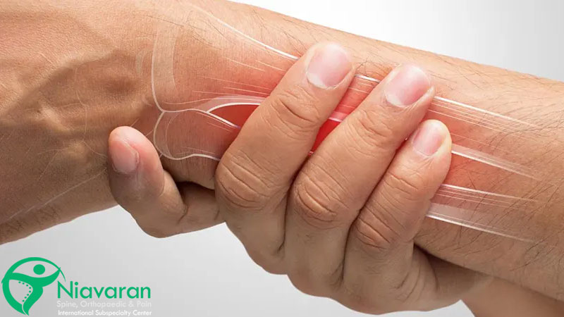 تاندونیت مچ دست