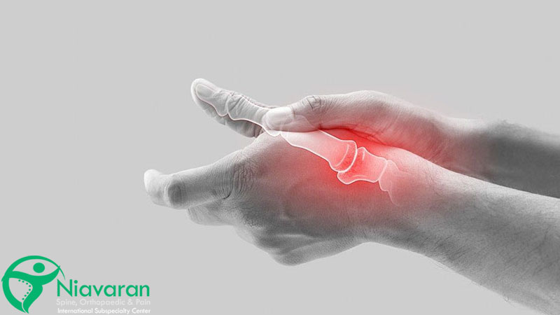 سندروم دکرون