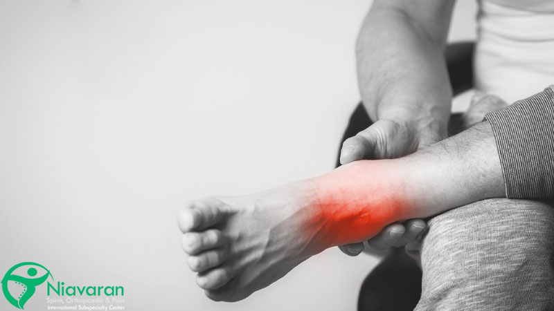 آرتریت پا یکی از بیماری های مچ پا