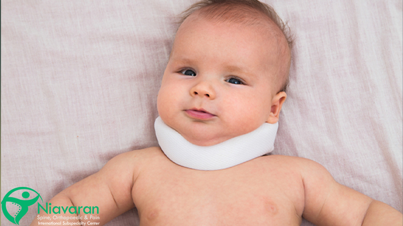 سندروم کلیپل فایل