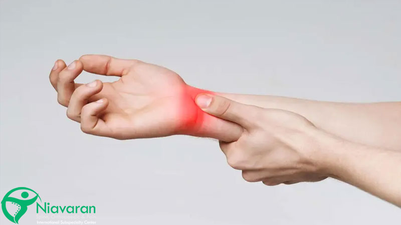 گرفتگی عصب دست