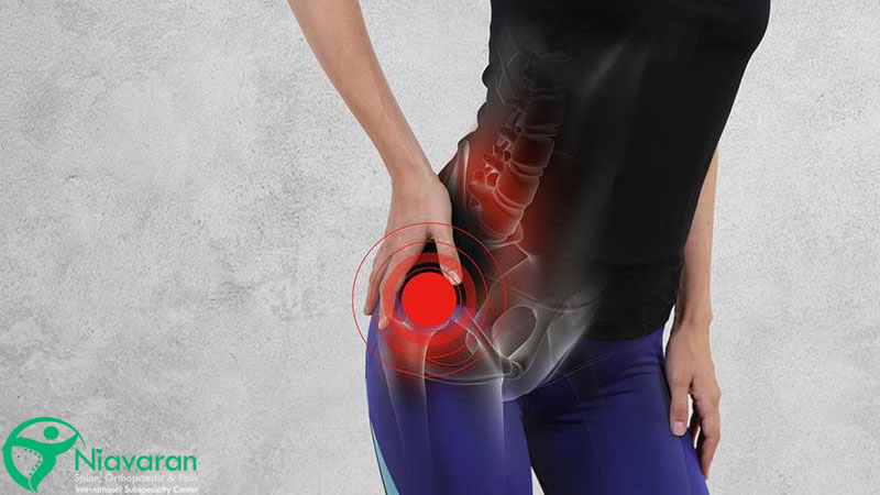 تاندولیت لگن