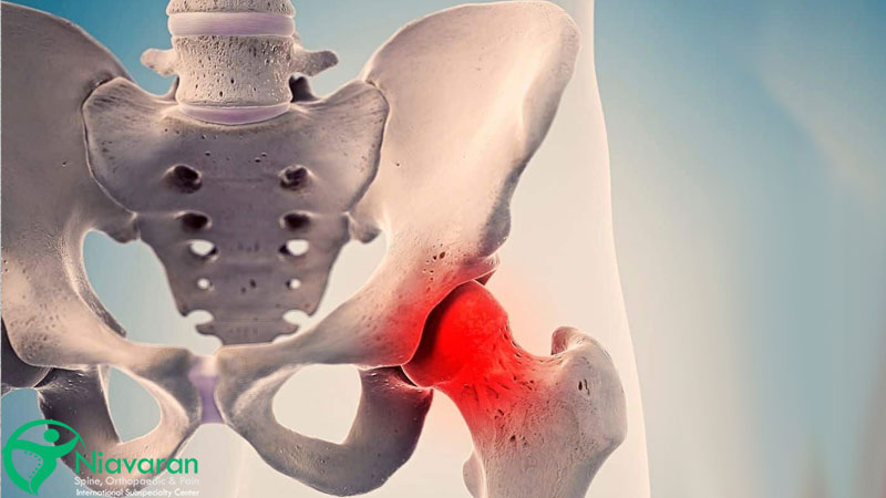 آسیب های لگنی