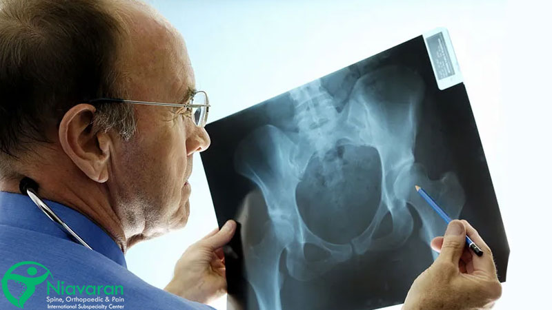 عکس برداری از لگن