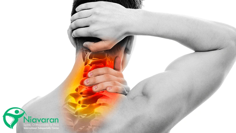 آرتروز گردن