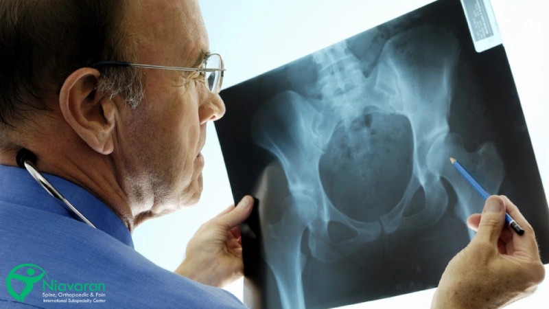 تشخیص افیوژن مفصل لگن