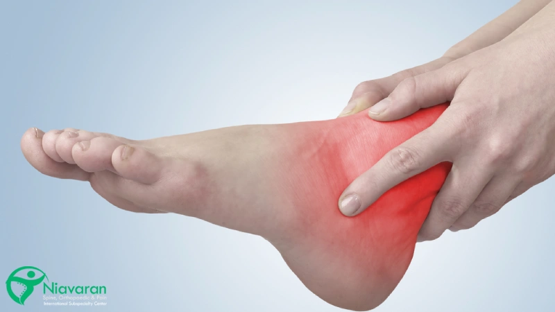 عوارض آب آوردن مچ پا