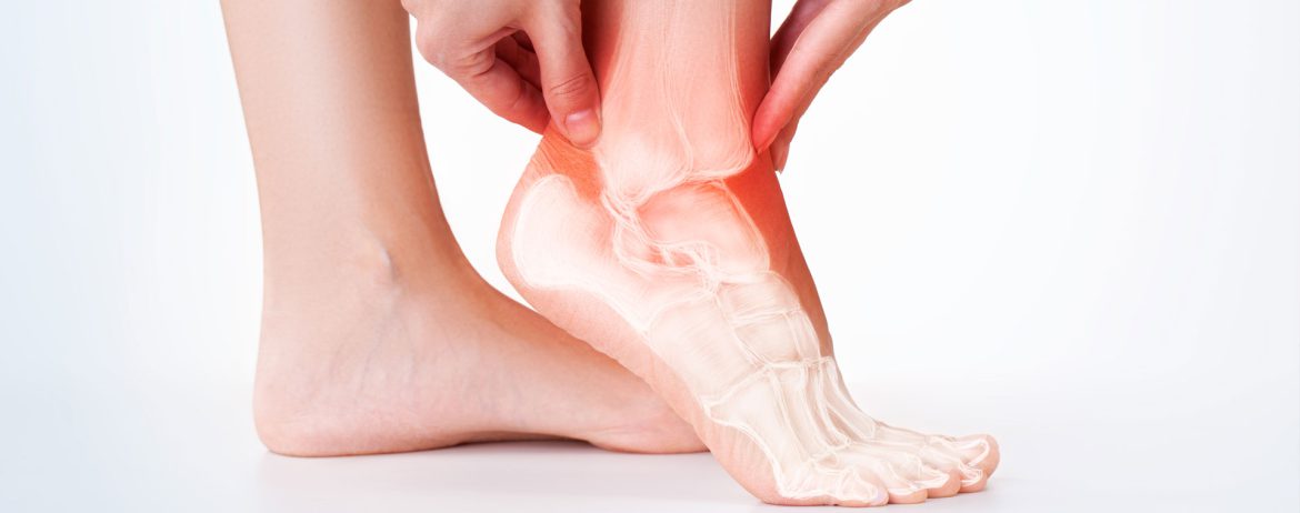 درمان ارتروز مچ پا توسط دکتر مچ پا