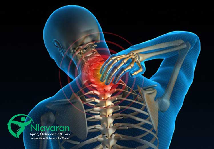 دیسک گردن خفیف