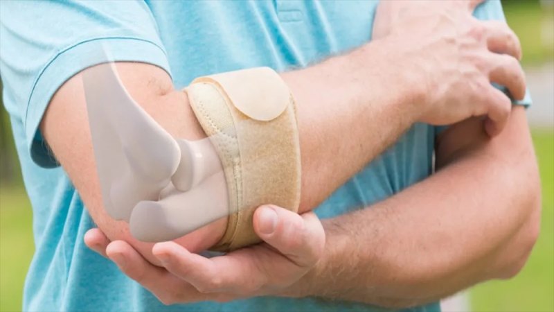 بیماری تنیس البو چیست