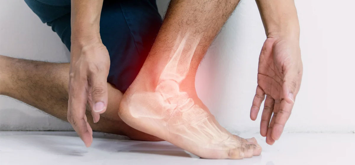 علت درد مچ پا، علائم و روش های درمان آن چیست؟