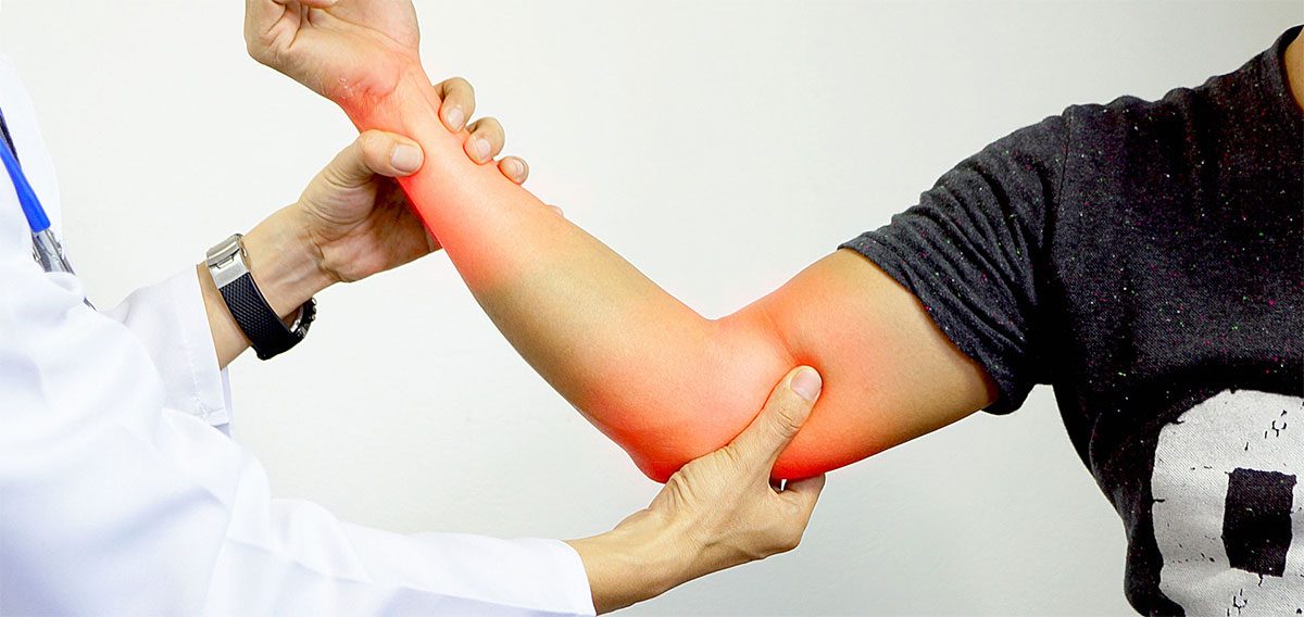 سندروم تونل کوبیتال؛ اگر آرنج دردناکی دارید، بخوانید!