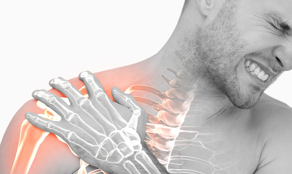 سندروم شانه ناپایدار چیست